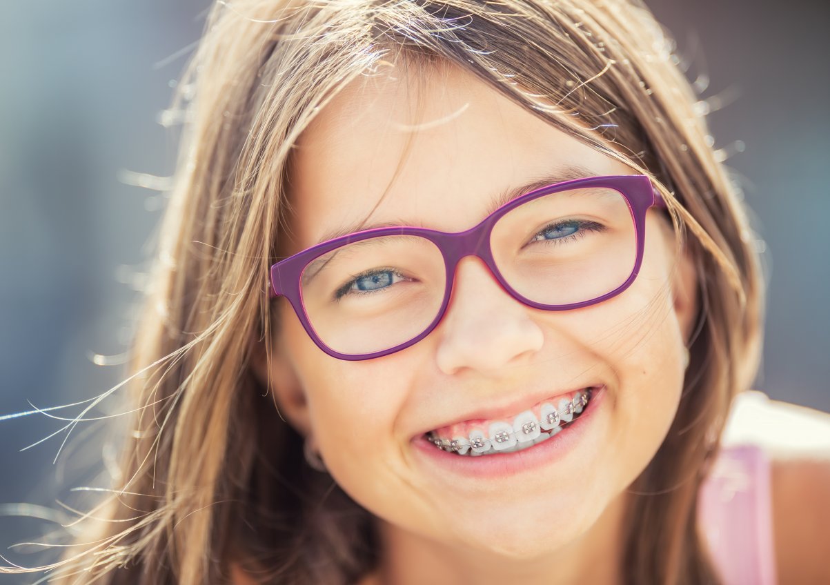 Happy smiling girl with dental braces and glasses. Young cute caucasian blond girl wearing teeth braces and glasses.