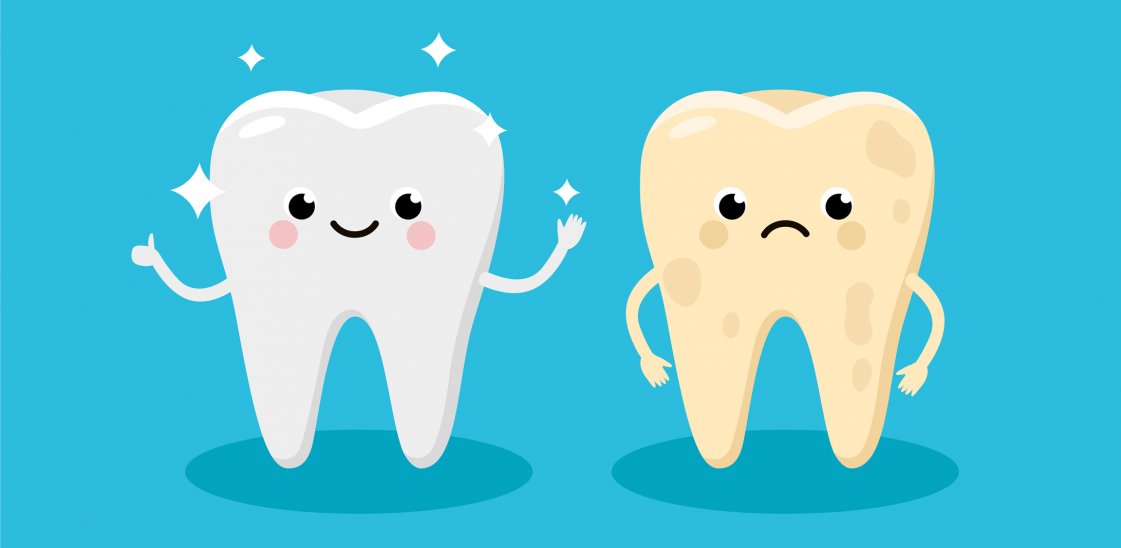 Cleaning and whitening teeth concept vector illustration. Snow-white Happy Tooth and Yellow Moody Tooth Cartoon characters in flat design. Tooth before and after whitening infographic elements