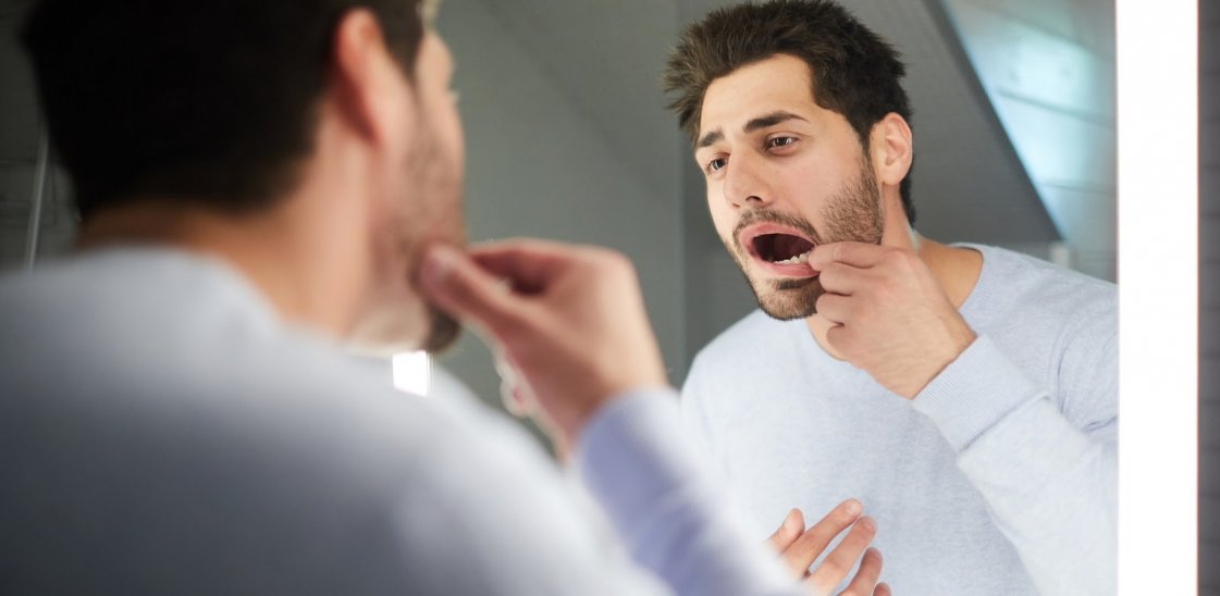 Man opening mouth to check for cavity