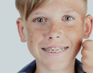 Young boy smiling with braces on