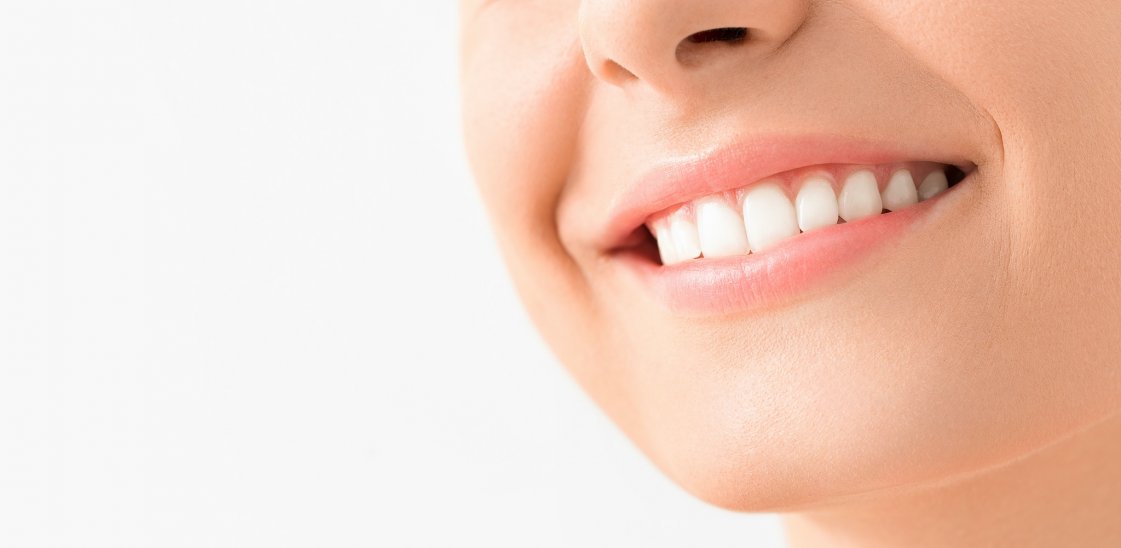 A woman smiling showing her teeth