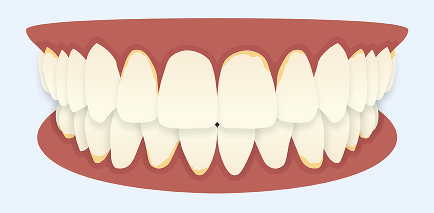 Illustration of a set of teeth