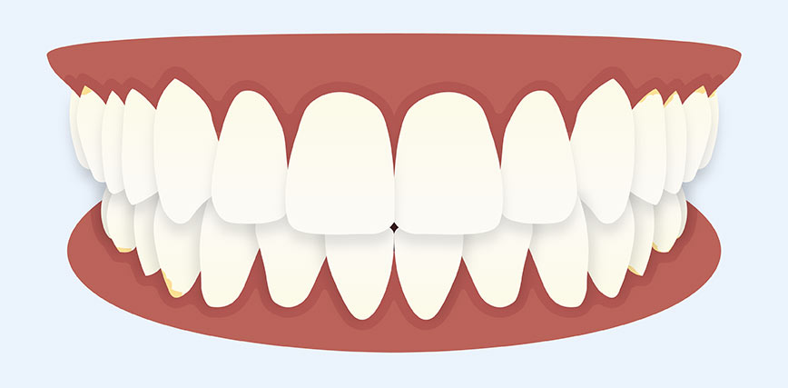 Illustration of a set of teeth