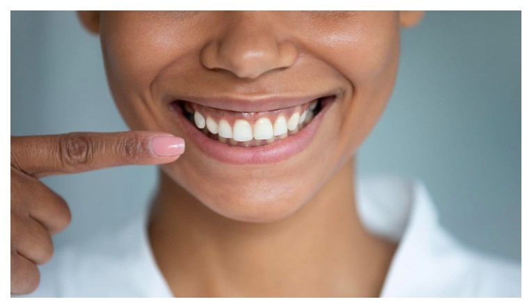 Woman pointing to her teeth smiling
