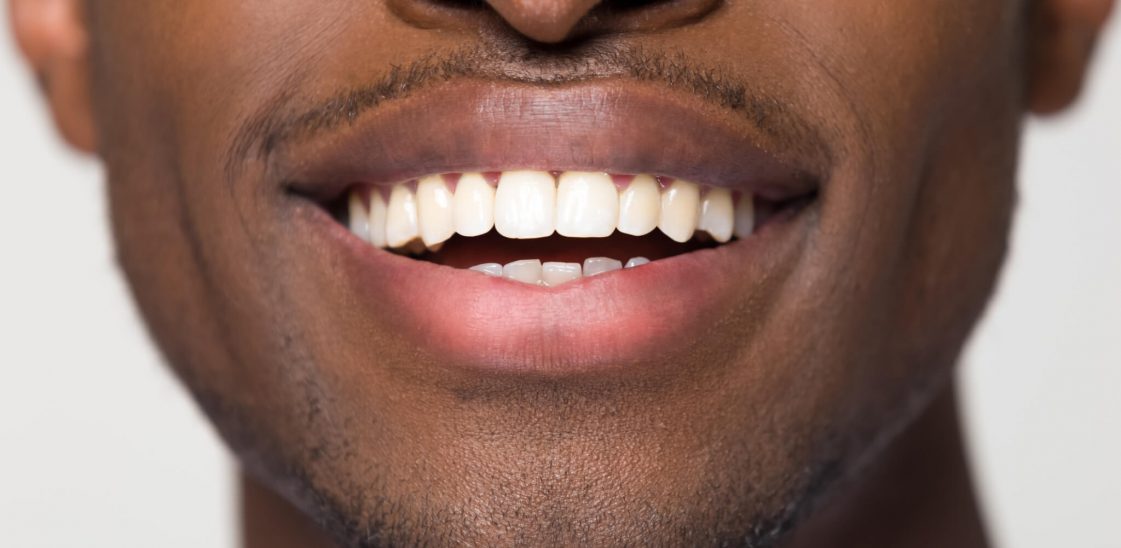 A man showing his teeth.