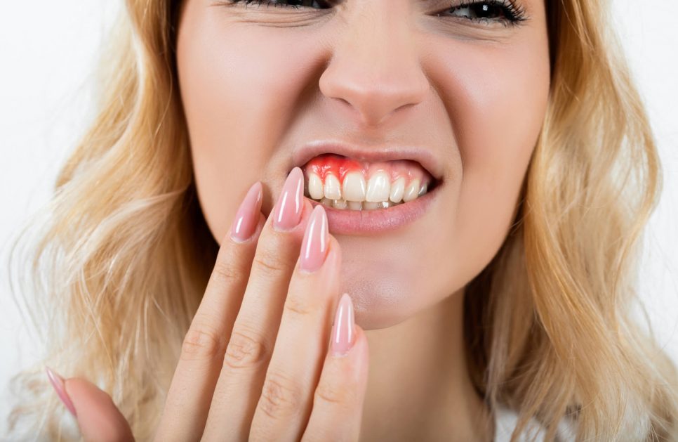 How to treat gum disease
