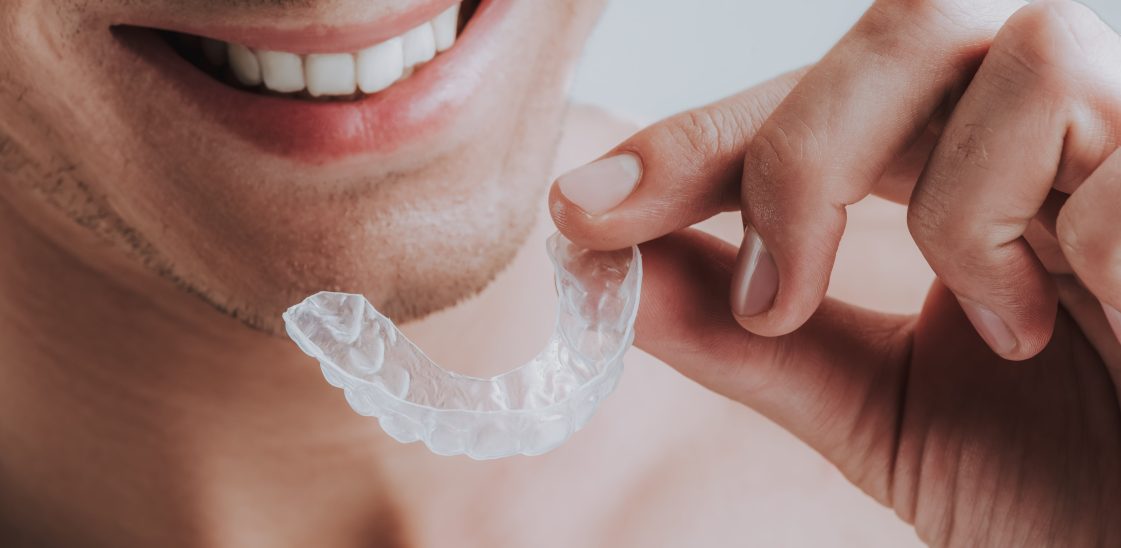 A smiling man puts a clear plastic dental guard into his mouth.