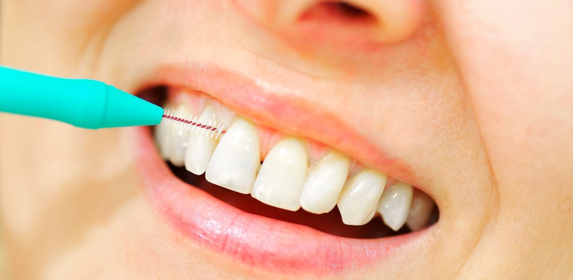 A woman using an interdental brush to clean between her teeth