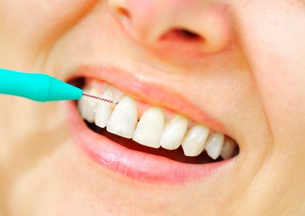 Can interdental brushes damage gums?