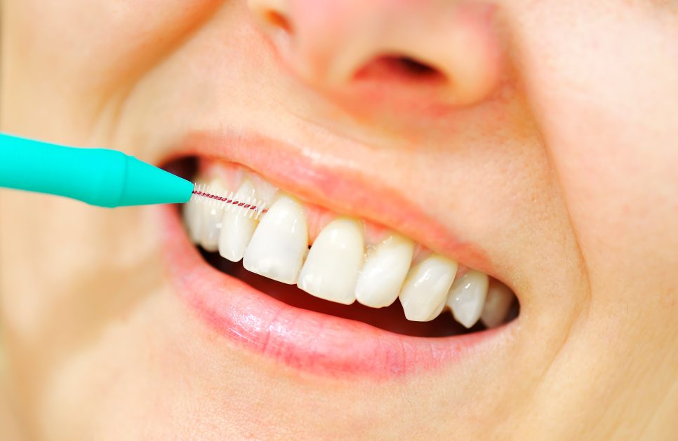 Can interdental brushes damage gums?