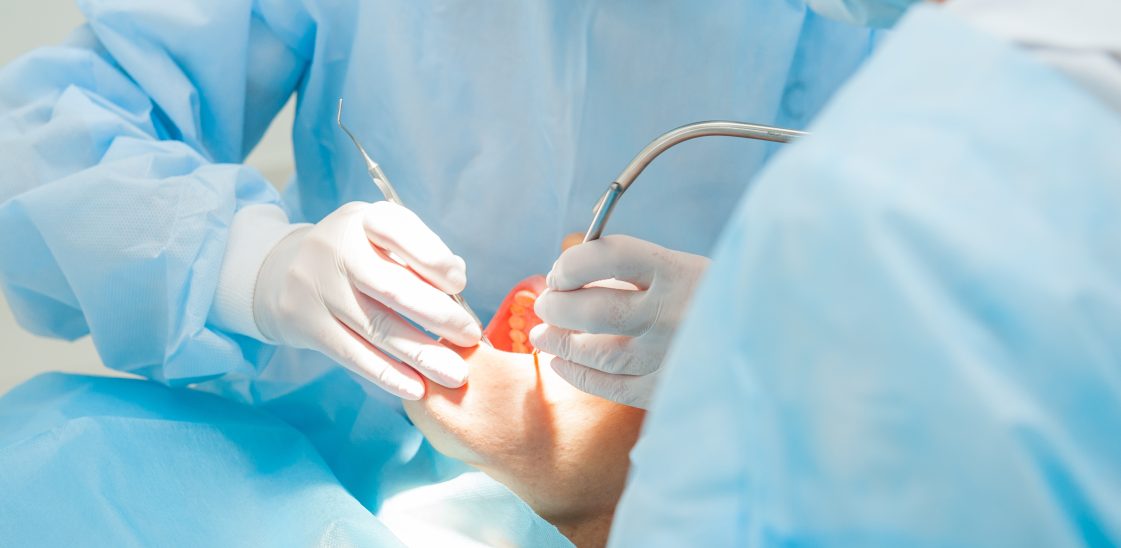 closeup of a patient’s open mouth as they have dental treatment