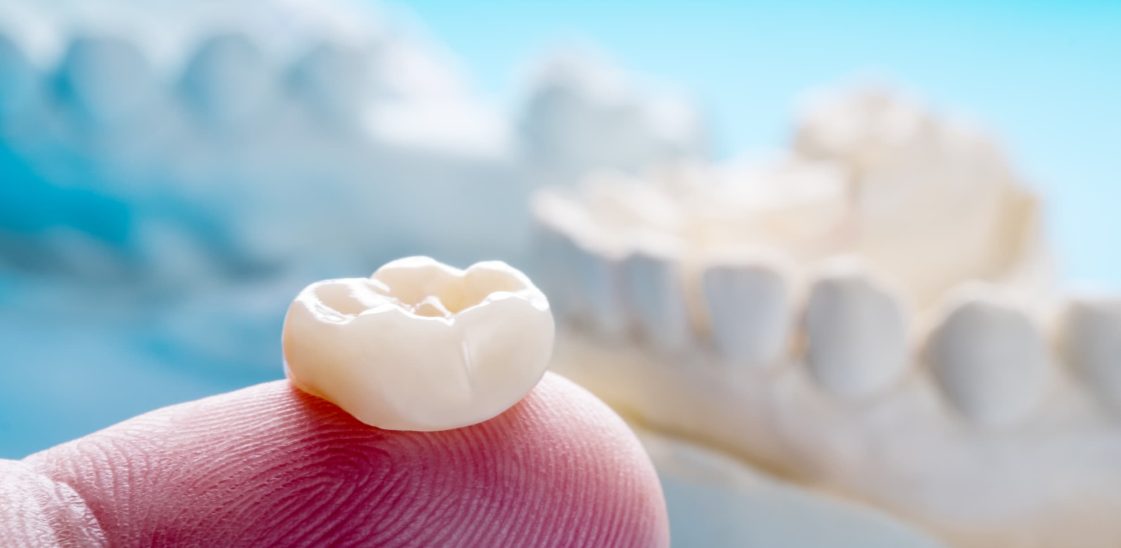 A close-up image of a dental crown resting on a fingertip.