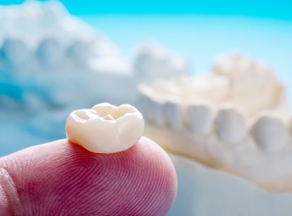 How long do dental crowns last?